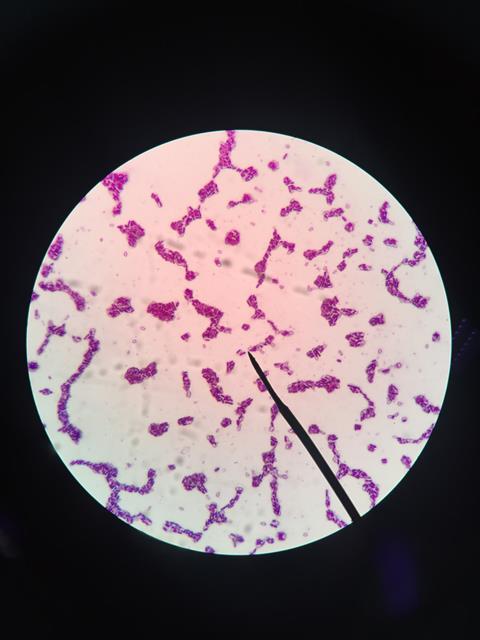 Clostridium botulinum under a microscope