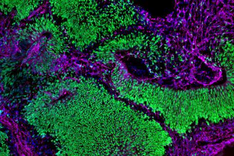Brain organoid