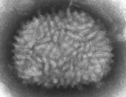 Vaccinia_virus_PHIL_2143_lores_410