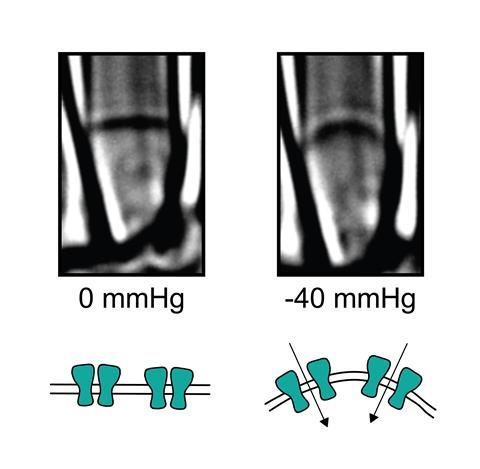 Piezo ion channels being mechanically-activated, before & after 