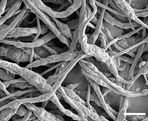 SEM image of the TPP at PVDF HFP microfibers