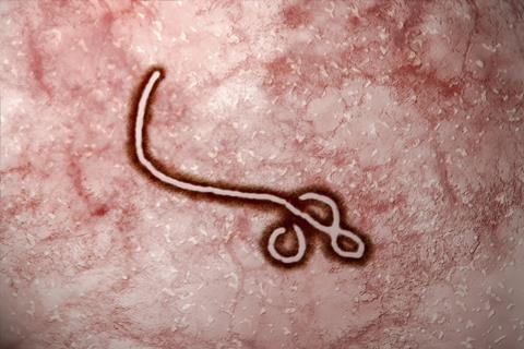 Microscopic view of Ebola Virus