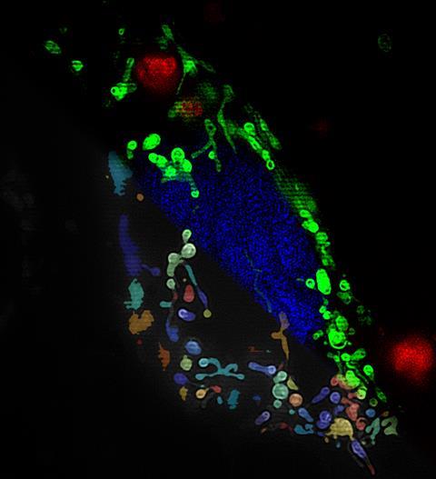 An image showing super-resolution imaging of breast cancer cells