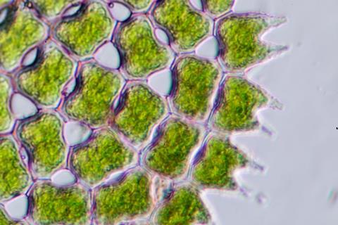 Phytoplankton sample under a microscope