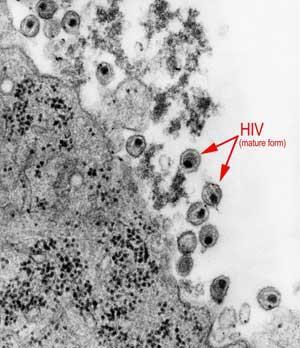 HIV-mature-forms-300