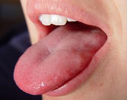tongue-250