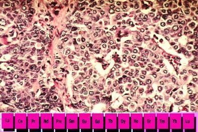 lanthanide-cancer-cells-395