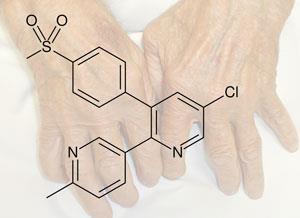 arcoxia-arthritis-300