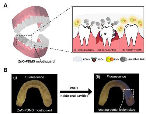 An image showing the ZnO-PDMS mouthguard