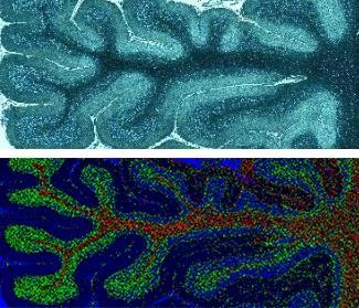 Imaging of human brain tissue