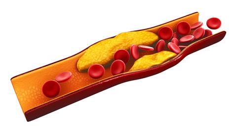 3d Illustration of blood cells with plaque buildup of cholesterol 