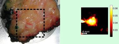 UK firm TeraView has developed THz technology that can identify tumours