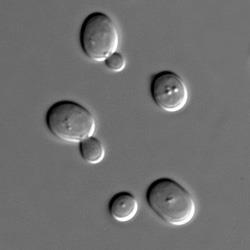 Yeast_microscopy_250