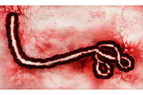 Microscopic view of Ebola Virus