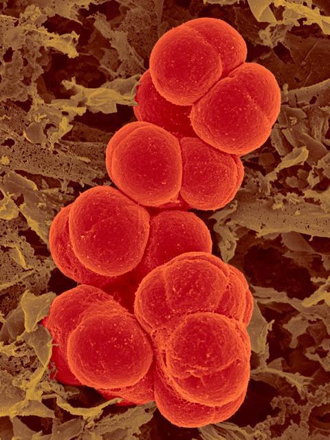 A coloured scanning microscope image showing red spherical cells stuck together tightly in an elongated arrangement