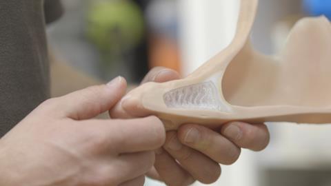 Artificial foot developed using 3D printed silicones