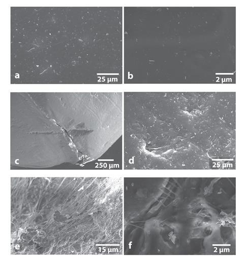 Microscope images showing intact surface of a new magnetic stir bar and different types of damage to the in-use stir bar surface