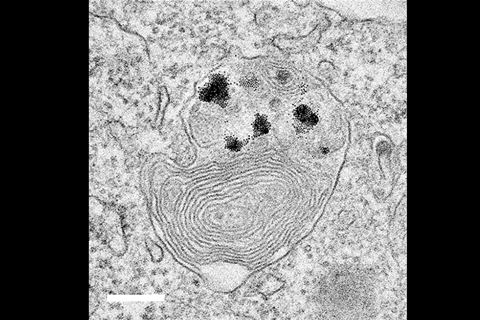 An image showing NPs in cancer lysosomes 