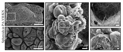 SEM images of tumour spheroids grown within PA-VH/KN hydrogels on day 14