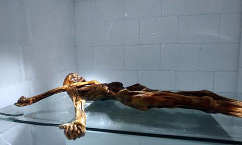 The mummy of Otzi the iceman