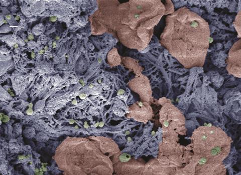 Nanoparticles (green) help form blood clots in injured liver