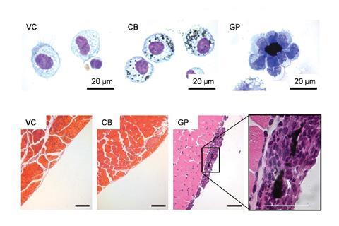 Lung reaction to graphene particles (GP) and carbon black (CB)