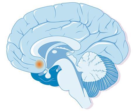 Diagram of the brain highlighting the nucleus accumbens