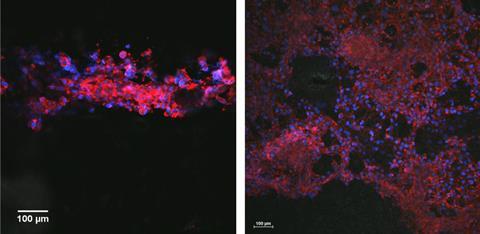 Two micrographs of purple blobs with red connections