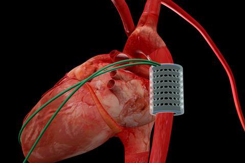 3D animation of the dielectric elastomer actuator augmented aorta