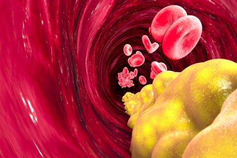 Cholesterol formation