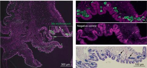 A micrograph showing a purple mass with some small green spots labelled Mp-erythromycin