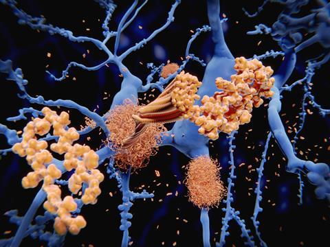 Illustration of amyloid-beta peptide accumulating on amyloid fibrils which build up as dense amyloid plaques, as seen in Alzheimer's disease