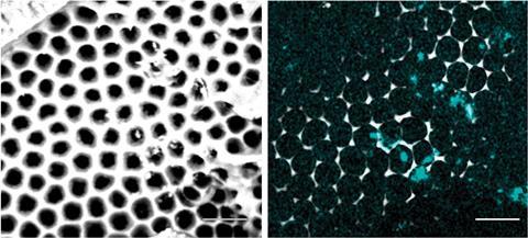 An image showing  nanoparticles getting entrapped across the skeleton