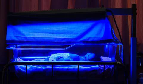 Newborn baby with neonatal jaundice and high bilirubin hyperbilirubinemia under blue light for phototherapy