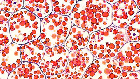 photomicrograph (microscopic image) of cross section of a seed, obtained inadvertently at the time of colonoscopy during biopsy of a colon polyp, stained with hematoxylin and eosin.