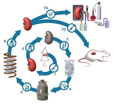 Depicted are the sequential steps of the nanowarming procedure as follows: (1) Kidney recovery from the donor; (2) Loading of cryoprotective agents (CPAs) and iron oxide nanoparticles (IONPs); (3) Rapid cooling to a vitrified state; (4) Storage at −150 °C