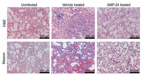 Histological images of h&e- and Masson-stained of lungs inoculated with A. baumannii and treated with AMP-24