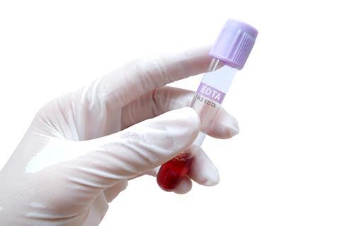 gloved hand holding a EDTA blood collection tube