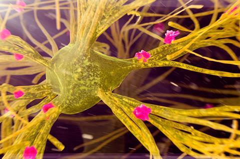 A digital artwork of a nerve cell with amyloid plaques