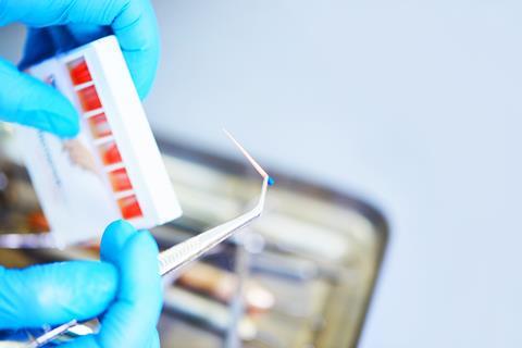 Dentist preparing gutta percha for use in dental surgery