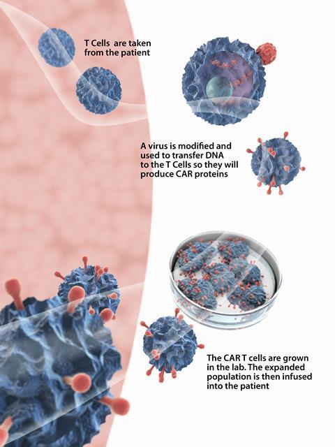 CAR-T cells immunotherapy