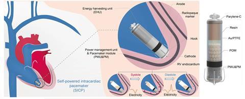 Pacemaker