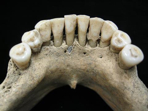 A picture of a 12th century nun's teeth 