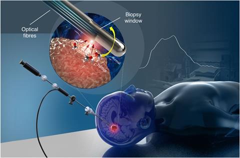 Schematic representation of the optical core needle biopsy, with a magnifed view of the tip showing the biopsy window and the beveled optical fbers used for illumination and detection