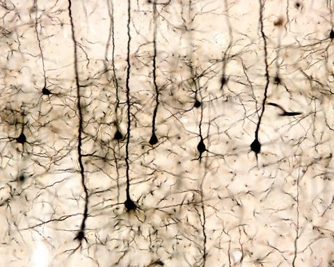 Pyramidal neurons of the cerebral cortex impregnated with the Golgi method
