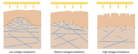 Geneu collagen breakdown