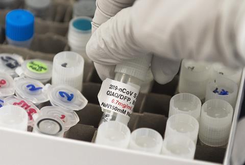 A photo of a hand in a latex glove taking a vial from a rack