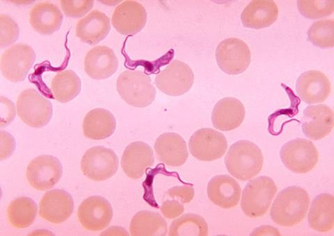 Blood smear from patient with African trypanosomiasis