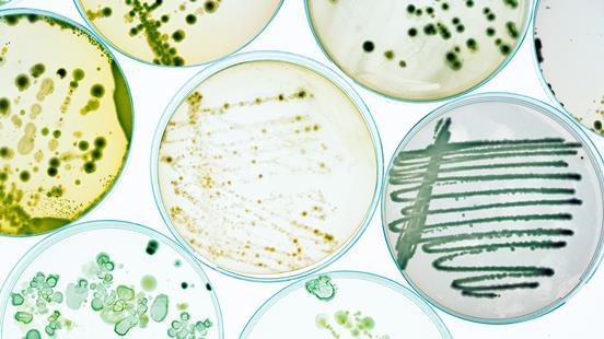 增长的培养皿bacteral文化