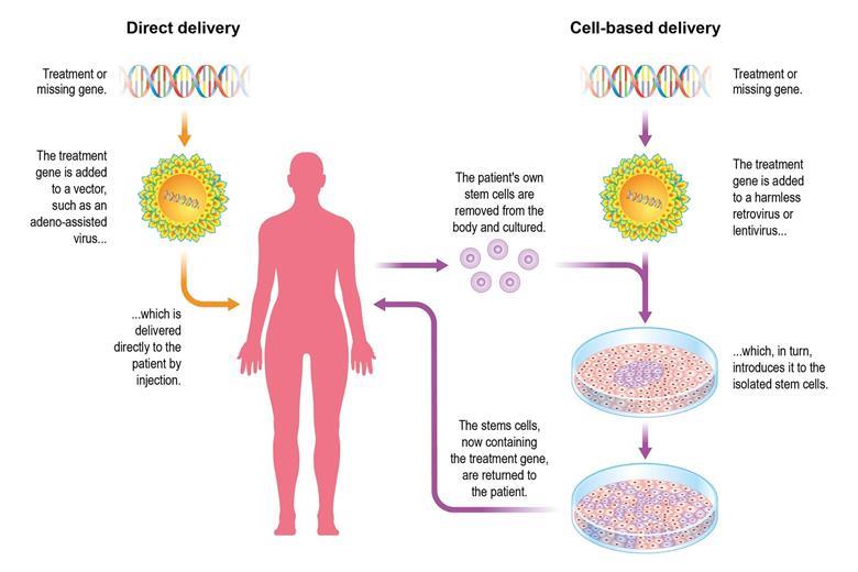 Delivering gene therapy | Feature | Chemistry World